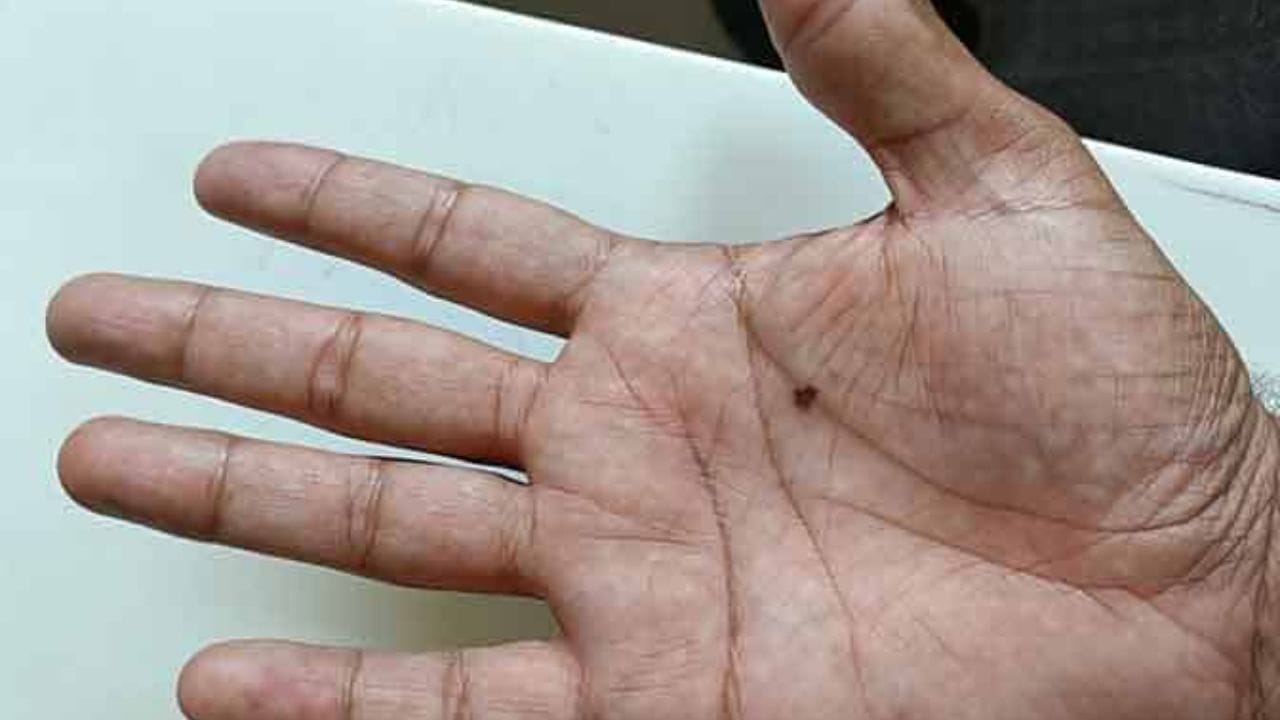 આવા લોકોના જીવનમાં પૈસાની કમી હોતી નથી. જો જમણી હથેળી પરનો તલ સ્પષ્ટ, ઊંડો અને મુખ્ય હોય, તો તે વધુ મહત્વપૂર્ણ માનવામાં આવે છે.