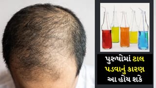 શું શુગરવાળા ડ્રિક્સ પુરુષોમાં વાળ ખરવાનું કારણ બને છે? જાણો શું કહે છે એક્સપર્ટ