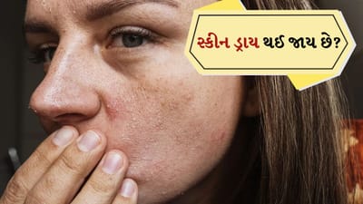 શિયાળામાં સ્કીન ડ્રાય થઈ જાય છે? તેને માખણ જેવી મુલાયમ રાખવા માટે આ ટિપ્સ કરો ફોલો