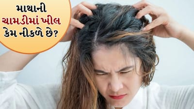 Hair care: વાળના મૂળની આસપાસ ખીલ કેમ નીકળે છે? ડર્મેટોલોજિસ્ટ પાસેથી જાણો