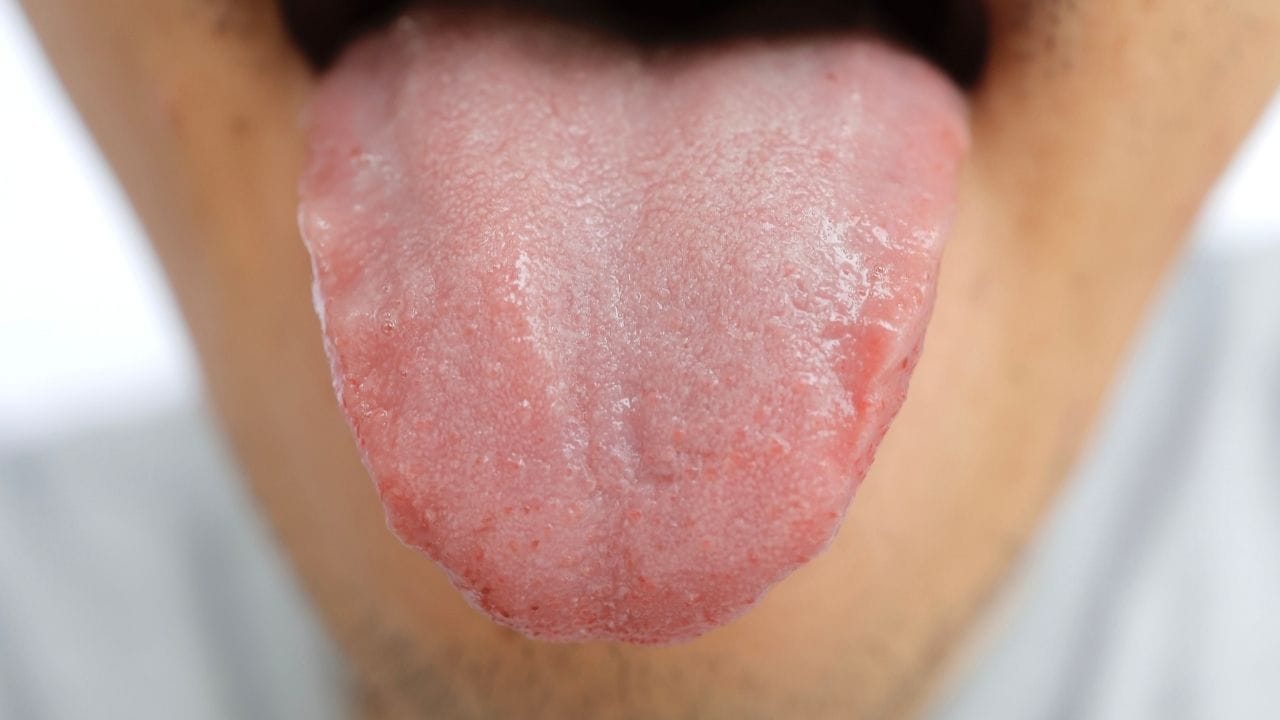 ઘણી વખત વધારે ગરમ ચા, કોફી અથવા મરચાંવાળા કે ખાટા ખોરાકના કારણે જીભ પર લાલાશ, સોજો અને નાના ફોલ્લા પણ થઈ શકે છે. આવી સ્થિતિમાં દાદીના ઘરગથ્થુ ઉપાયો ખૂબ અસરકારક સાબિત થાય છે. સારી વાત એ છે કે આ ઉપાયોમાં વપરાતી વસ્તુઓ સરળતાથી ઘરમાં ઉપલબ્ધ હોય છે.