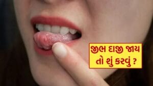 Tongue Burn Remedies : ગરમા ગરમ ચા પીધા પછી જીભ બળી જાય તો શું કરવું? જાણી લો