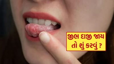 ચા કે કોફી પીતી વખતે ઘણીવાર આપણે અજાણતા જ જીભ બળી લઈએ છીએ. હાથ કે પગ બળી જાય ત્યારે લોકો તરત એલોવેરા કે ટૂથપેસ્ટ લગાવે છે, પરંતુ જીભ બળી જાય ત્યારે શું કરવું જોઈએ, એ વિશે બહુ ઓછા લોકો જાણે છે. જીભ બળવાથી માત્ર બળતરા જ નહીં, પરંતુ પછી કંઈ પણ ખાવા-પીવામાં અસ્વસ્થતા પણ અનુભવાય છે.