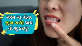 ચા પીવાથી જીભ આકસ્મિક રીતે બળી જાય તો શું કરવું?