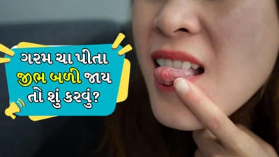 Home Remedies: ચા પીવાથી જીભ આકસ્મિક રીતે બળી જાય તો શું કરવું? આ ઘરગથ્થુ ઉપચાર અપનાવો