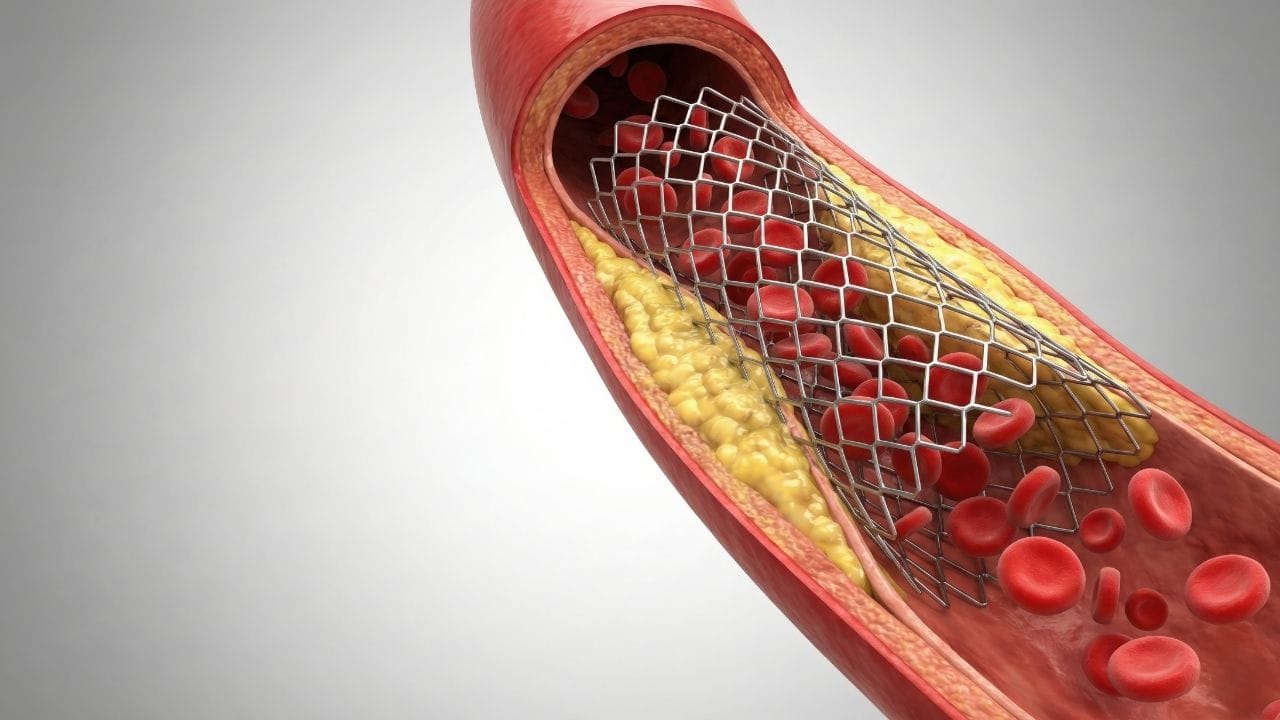 સફરજનને સંતુલિત કોલેસ્ટ્રોલ સ્તર જાળવવામાં મદદરૂપ માનવામાં આવે છે. સફરજનનું નિયમિત સેવન હૃદયના સ્વાસ્થ્યને સુધારવામાં મદદ કરે છે અને હૃદય સંબંધિત સમસ્યાઓનું જોખમ ઘટાડે છે.