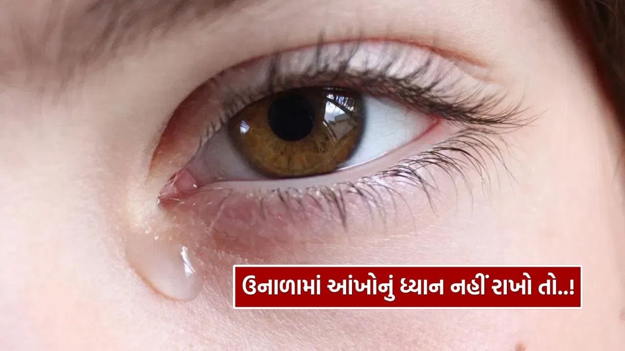 ઉનાળાના તીવ્ર અલ્ટ્રાવાયોલેટ કિરણો આંખો માટે ખાસ કરીને હાનિકારક હોય છે. ઘણીવાર લોકો ત્વચાની રક્ષા માટે સનસ્ક્રીન લગાવે છે, પરંતુ આંખોની સુરક્ષા અવગણે છે. જેના કારણે એલર્જી, નેત્રસ્તર દાહ (કંજક્ટિવાઇટિસ), શુષ્કતા અને બળતરા જેવી સમસ્યાઓ ઊભી થાય છે. ઉનાળામાં આ પ્રકારના ચેપના કેસોમાં પણ વધારો જોવા મળે છે, જે બેક્ટેરિયા અથવા વાયરસથી થાય છે અને લાલાશ, ખંજવાળ તેમજ ચીકણું સ્રાવ જેવી લક્ષણો આપે છે.