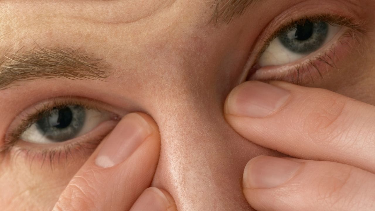 નિષ્ણાતોના મુજબ, તીવ્ર યુવી કિરણો કોર્નિયાને પણ નુકસાન પહોંચાડી શકે છે. આ સ્થિતિને ફોટોકેરાટાઇટિસ કહેવામાં આવે છે, જેને ‘આંખોનું સનબર્ન’ પણ કહેવાય છે. તેમાં આંખમાં દુખાવો, પાણી આવવું અને પ્રકાશ પ્રત્યે સંવેદનશીલતા જેવા લક્ષણો જોવા મળે છે. ખાસ કરીને બપોરે 12 થી 4 દરમિયાન સૂર્યપ્રકાશ વધુ તીવ્ર હોય છે, તેથી આ સમયે બહાર જવાનું ટાળવું અથવા સનગ્લાસ પહેરવા જરૂરી છે.