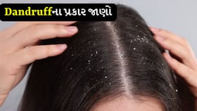 ખોડો દૂર કરવા માટે ઘરેલું નુસખા: સરળ અને અસરકારક રીતો