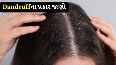 Dandruff: ખોડો કેટલા પ્રકારનો હોય છે? આ ઘરેલું ઉપચારોથી રાહત મેળવો