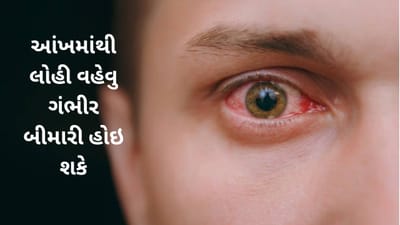 Bleeding From Eyes Cause: 20 વર્ષની છોકરીનું આંખોમાંથી લોહી નીકળવાથી મોત, જાણો આ રોગ શું છે અને તે કેટલો ખતરનાક છે.