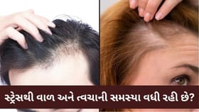 વધુ સ્ટ્રેસથી વાળ અને ત્વચા પર ગંભીર અસર, સમયસર સાવચેત રહો