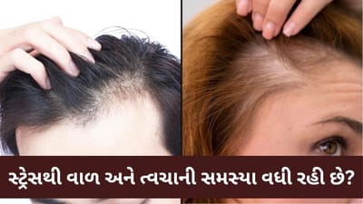 Hair Fall : વધુ સ્ટ્રેસ લેવાથી વાળ અને ત્વચા પર શું અસર પડે છે? જાણો મહત્વપૂર્ણ માહિતી