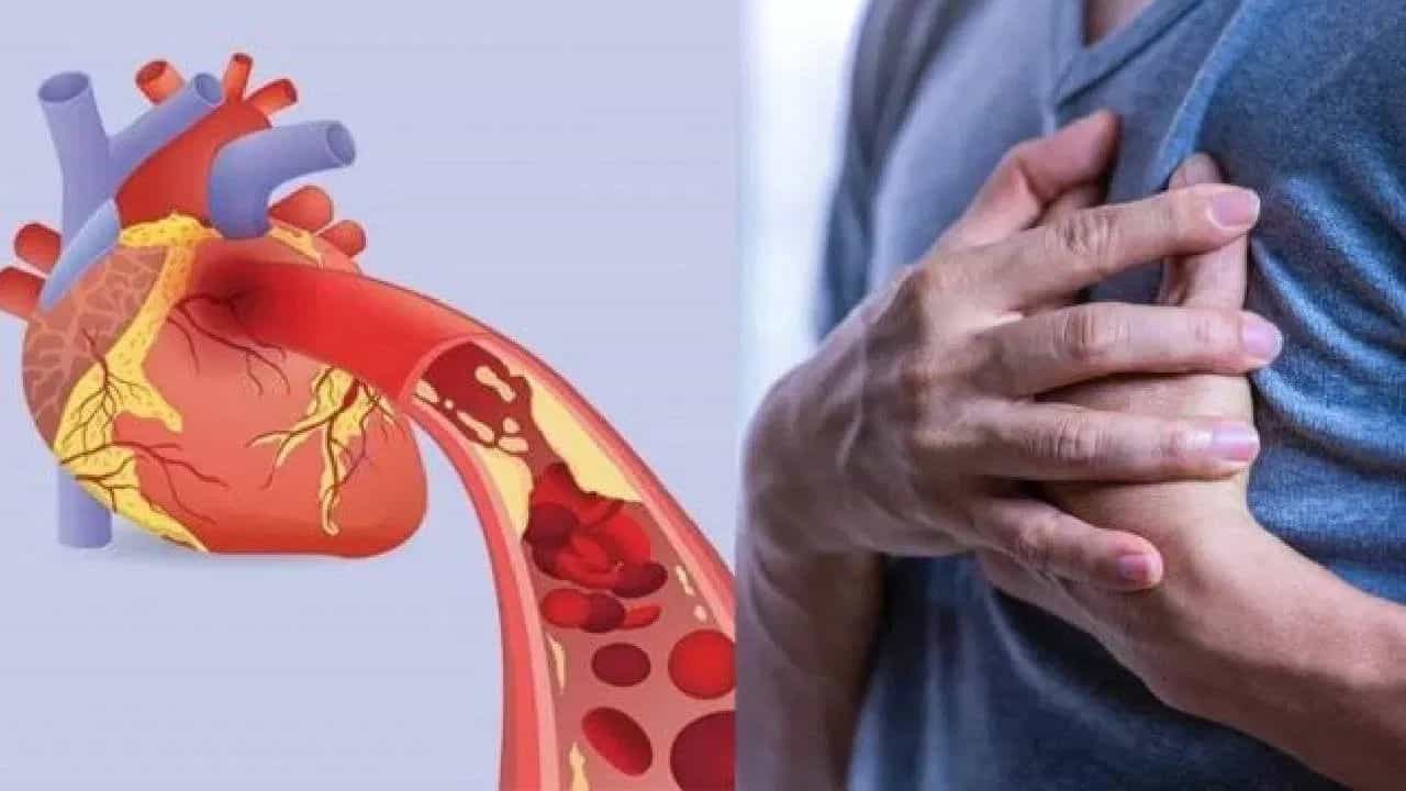 જો હૃદયમાં બ્લોકેજ હોય, તો આ લક્ષણો દેખાય છે, જાણો ડૉક્ટરે શું કહ્યુ