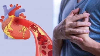 જો હૃદયમાં બ્લોકેજ હોય, તો આ લક્ષણો દેખાય છે, જાણો ડૉક્ટરે શું કહ્યુ