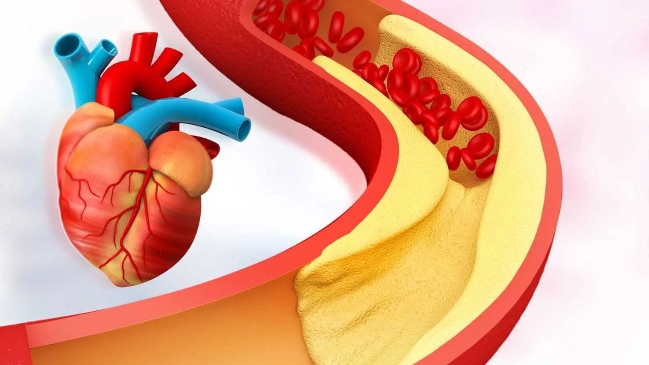 આ સિવાય આનુવંશિક પરિબળો પણ મહત્વની ભૂમિકા ભજવે છે. જો પરિવારમાં કોઈને કોલેસ્ટ્રોલ વધારે હોવાનો ઇતિહાસ હોય, તો પાતળા લોકોમાં પણ તેનો જોખમ વધી શકે છે. કેટલાક લોકોમાં શરીરની ચયાપચય પ્રક્રિયા અથવા ચરબી સંભાળવાની રીત અલગ હોઈ શકે છે, જેના કારણે સામાન્ય વજન હોવા છતાં કોલેસ્ટ્રોલનું પ્રમાણ વધી શકે છે. તેથી માત્ર શરીરના વજનને આધારે કોલેસ્ટ્રોલનું મૂલ્યાંકન કરવું યોગ્ય નથી. નિયમિત આરોગ્ય તપાસ અને સ્વસ્થ જીવનશૈલી ખૂબ જરૂરી છે.