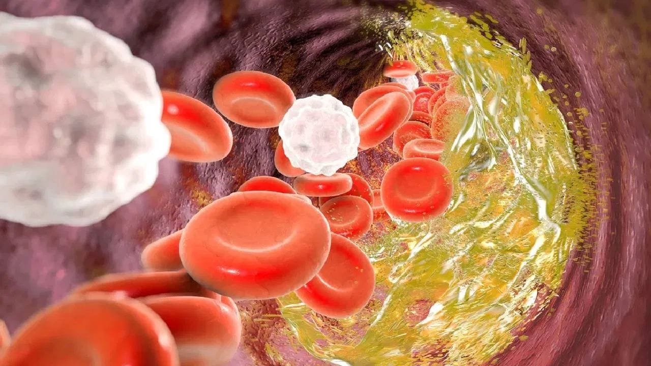 કોલેસ્ટ્રોલનું સ્તર નિયંત્રિત રાખવા માટે સ્વસ્થ જીવનશૈલી અપનાવવી ખૂબ જરૂરી છે. રોજિંદા આહારમાં તાજા ફળો, શાકભાજી, આખા અનાજ અને ફાઇબરયુક્ત ખોરાકનો સમાવેશ કરવો લાભદાયક છે. સાથે સાથે તળેલા અને પ્રોસેસ્ડ ખોરાકનું સેવન ઓછું કરવું જોઈએ.