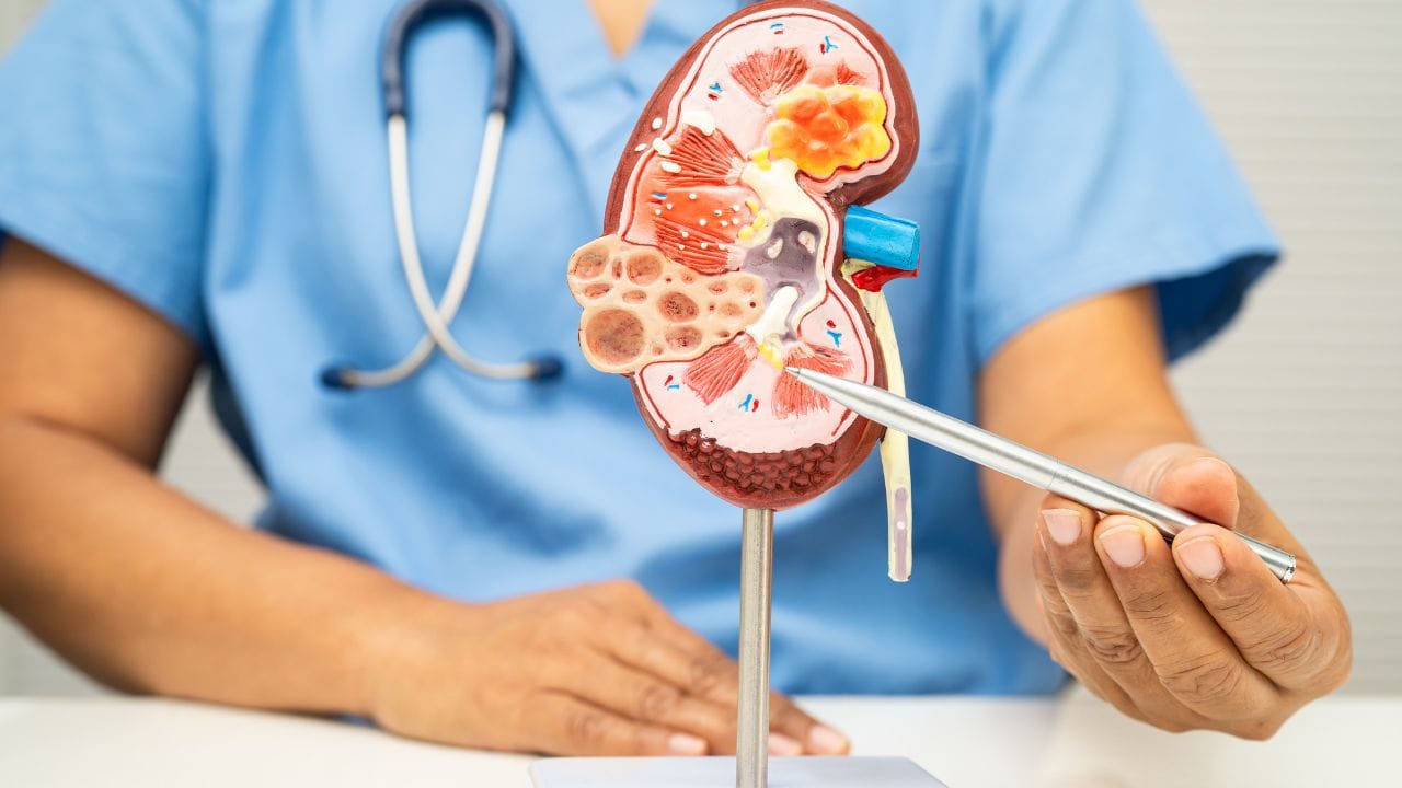 કિડનીનું સ્વાસ્થ્ય જાળવવા માટે પૂરતું પાણી પીવું, સંતુલિત આહાર લેવો અને નિયમિત વ્યાયામ કરવો ખૂબ જરૂરી છે. યોગ્ય જીવનશૈલી અપનાવીને કિડનીમાં પથરી બનવાનું જોખમ ઘણું ઓછું કરી શકાય છે. (નોંધ : અહીં આપવામાં આવેલી માહિતી ફક્ત આપની જાણકારી માટે છે. કોઈ પણ સ્વાસ્થ્યને લગતી માહિતી માટે નિષ્ણાંતો પાસેથી સલાહ લેવી જરૂરી છે.)