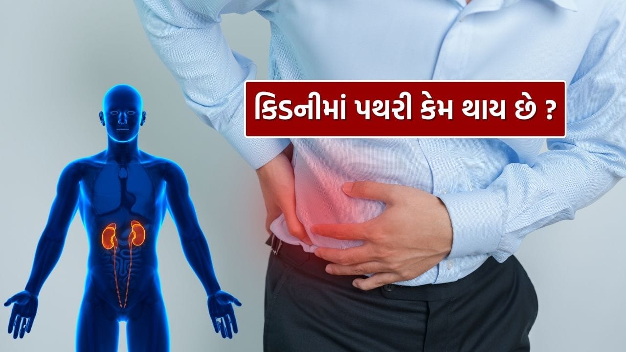 વિશ્વ કિડની દિવસ દર વર્ષે માર્ચ મહિનાના બીજા ગુરુવારે ઉજવવામાં આવે છે. તેનો મુખ્ય હેતુ કિડનીના સ્વાસ્થ્ય વિશે લોકોમાં જાગૃતિ લાવવાનો છે. કિડની આપણા શરીરનું એક મહત્વપૂર્ણ અંગ છે, જે લોહીને શુદ્ધ કરે છે, ઝેરી તત્વોને બહાર કાઢે છે અને શરીરમાં પાણી તથા ખનિજનું સંતુલન જાળવે છે. પરંતુ અનિયમિત જીવનશૈલી, અપૂરતું પાણી પીવું અને ખોરાકની ખરાબ આદતોના કારણે કિડની સંબંધિત સમસ્યાઓ ઝડપથી વધી રહી છે. તેમાં સૌથી સામાન્ય સમસ્યા કિડનીમાં પથરી થવાની છે.