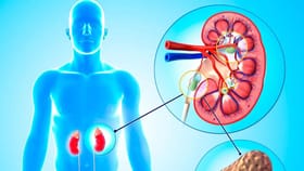 શું કિડનીમાં પથરી હોય તો દૂધ પીવું જોઈએ