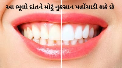 રોજની આ 5 આદતો તમારા દાંતને ધીમે ધીમે બગાડી રહી છે, સમયસર સાવચેત થાઓ