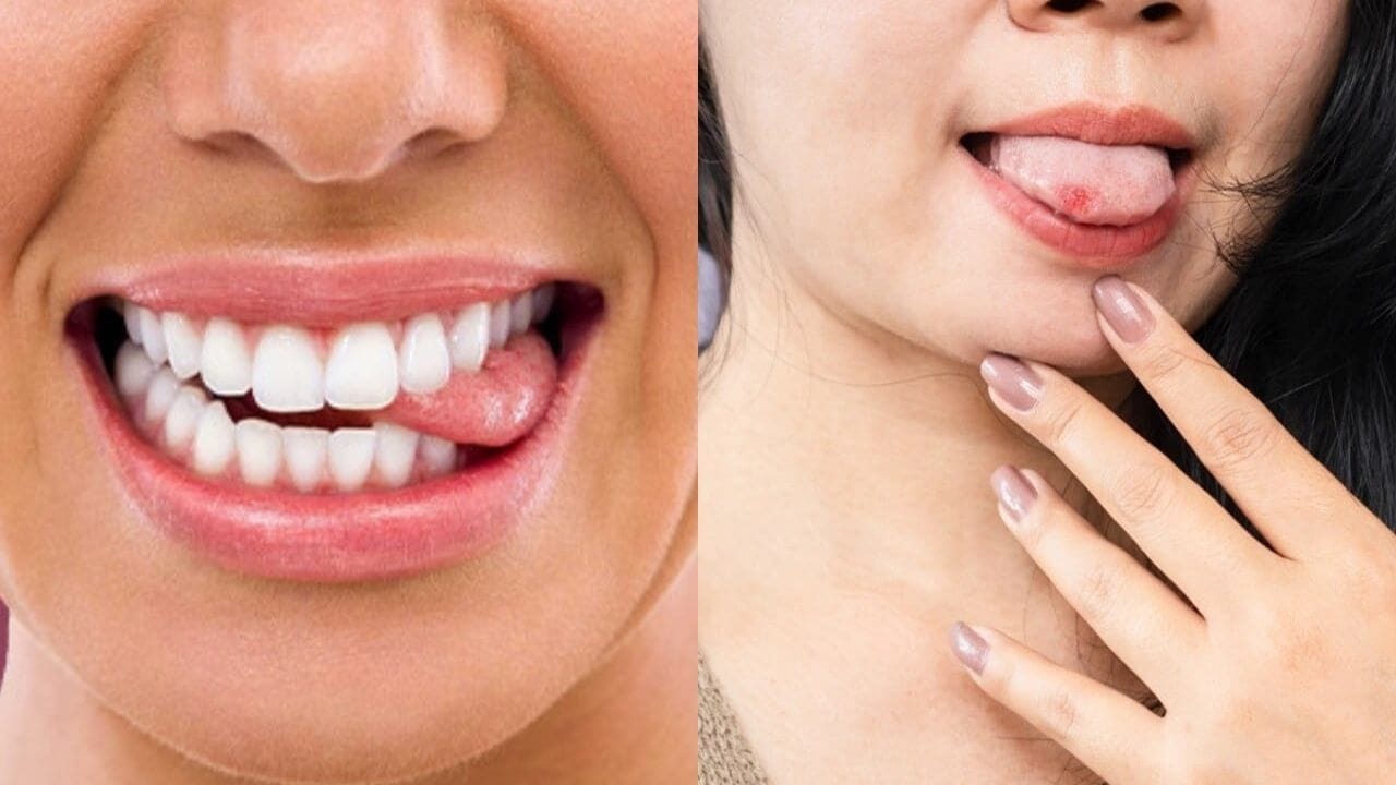 ભારતીય લોકમાન્યતાઓ મુજબ, જીભ કરડવીને ઘણીવાર અશુભ શુકન તરીકે જોવામાં આવે છે. એવી માન્યતા છે કે જ્યારે કોઈની જીભ અચાનક કરડાઈ જાય, ત્યારે તે કોઈ ગેરસમજ, વિવાદ અથવા અનિચ્છનીય પરિસ્થિતિનો સંકેત હોઈ શકે છે.