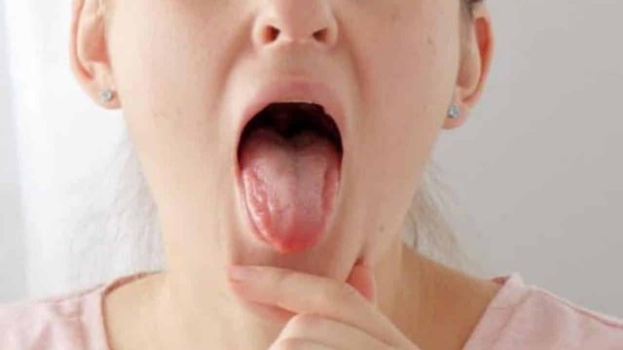 તેથી વારંવાર જીભ કરડાઈ જાય તો તે વિટામિનની ઉણપ અથવા મોઢા સંબંધિત અન્ય સમસ્યાનો સંકેત પણ હોઈ શકે છે. આવી સ્થિતિમાં તબીબી સલાહ લેવી યોગ્ય રહે છે. (નોંધ: અહીં આપવામાં આવેલી માહિતી માત્ર સામાન્ય જાણકારી માટે છે.)