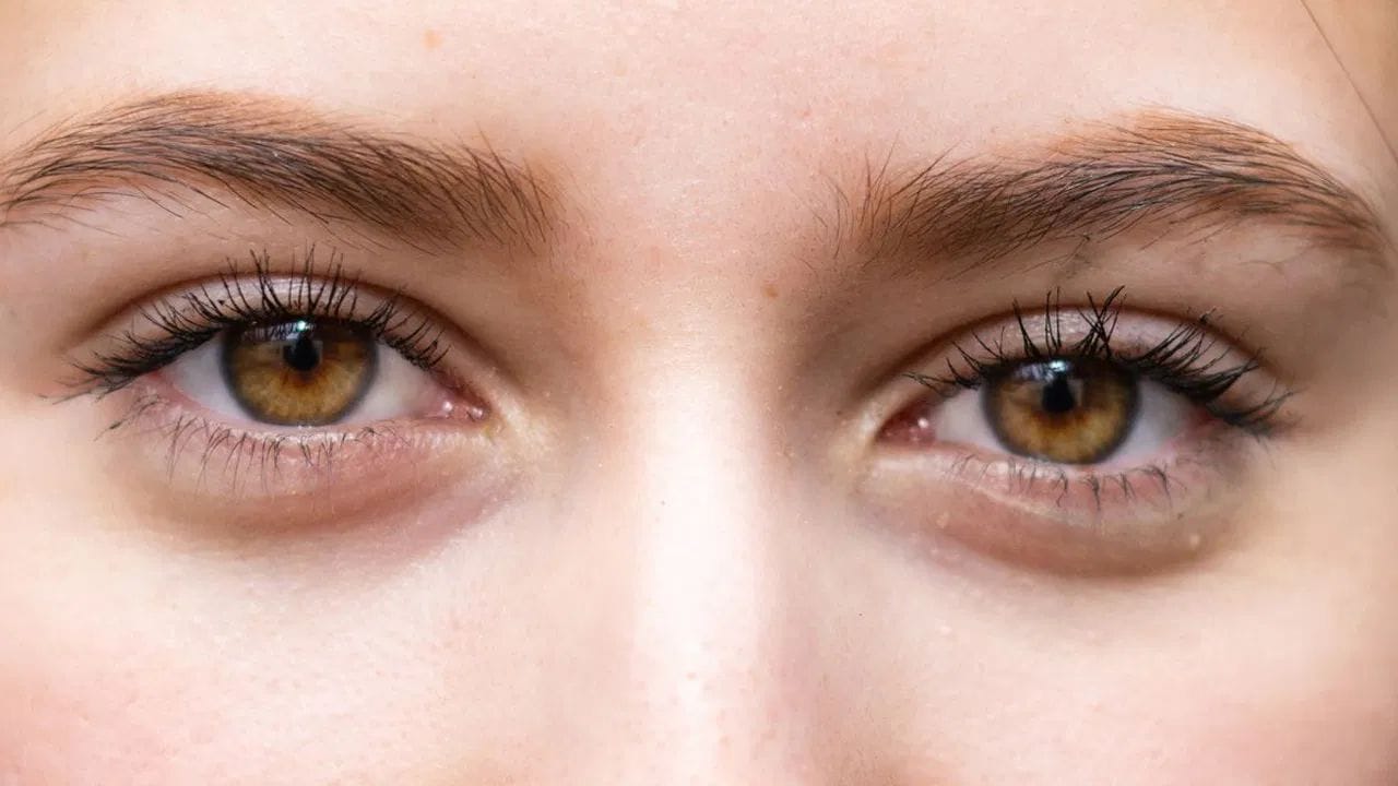 આંખોને હાઇડ્રેટેડ (ભીજાયેલી) રાખવી ખૂબ જરૂરી છે: નિષ્ણાતના જણાવ્યા અનુસાર, હાઇડ્રેશન સૌથી મહત્વપૂર્ણ છે. ઉનાળાની ઋતુમાં આંખોમાં શુષ્કતા (Dryness) એક સામાન્ય સમસ્યા છે. ગરમીની સાથે ફૂંકાતા ગરમ પવનો આંખોમાં બળતરા પેદા કરી શકે છે. તેથી, પૂરતા પ્રમાણમાં પ્રવાહીનું સેવન કરવું જરૂરી છે, કારણ કે તે તમારા શરીરને આંખોની સુરક્ષા માટે જરૂરી આંસુ બનાવવામાં મદદ કરે છે. આલ્કોહોલ અને કેફીનનું સેવન ઓછું કરવું હિતાવહ છે.