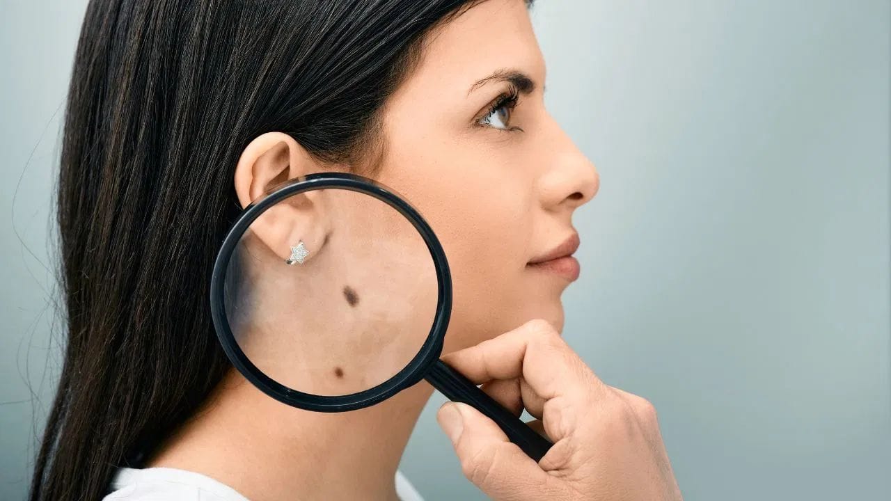 ગળા પર તલ હોય તો તે વ્યક્તિ માટે માન-સન્માન અને પ્રગતિના સંકેત માનવામાં આવે છે. છાતી પર તલ પણ મહત્વપૂર્ણ છે – જમણી બાજુએ હોય તો સુખદ જીવન તરફ ઈશારો કરે છે, જ્યારે ડાબી બાજુએ હોય તો આર્થિક પડકારો આવી શકે.