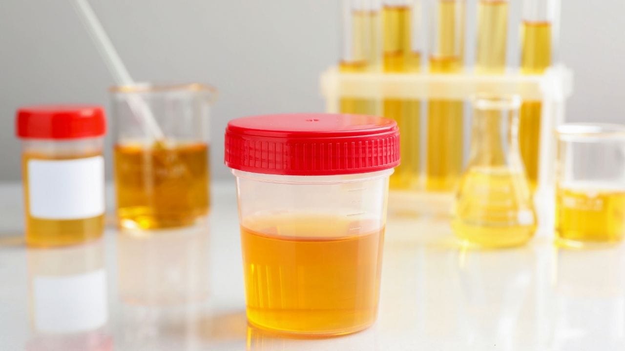 પેશાબમાં લોહી આવવાથી કેટલાક સામાન્ય લક્ષણો દેખાઈ શકે છે. જેમ કે પેશાબનો રંગ ગુલાબી, લાલ અથવા ગાઢ થઈ જવો, પેશાબ કરતી વખતે બળતરા કે દુખાવો, વારંવાર પેશાબ કરવાની ઈચ્છા, પેટ કે પીઠમાં દુખાવો, અને ચેપના કારણે તાવ આવવો.