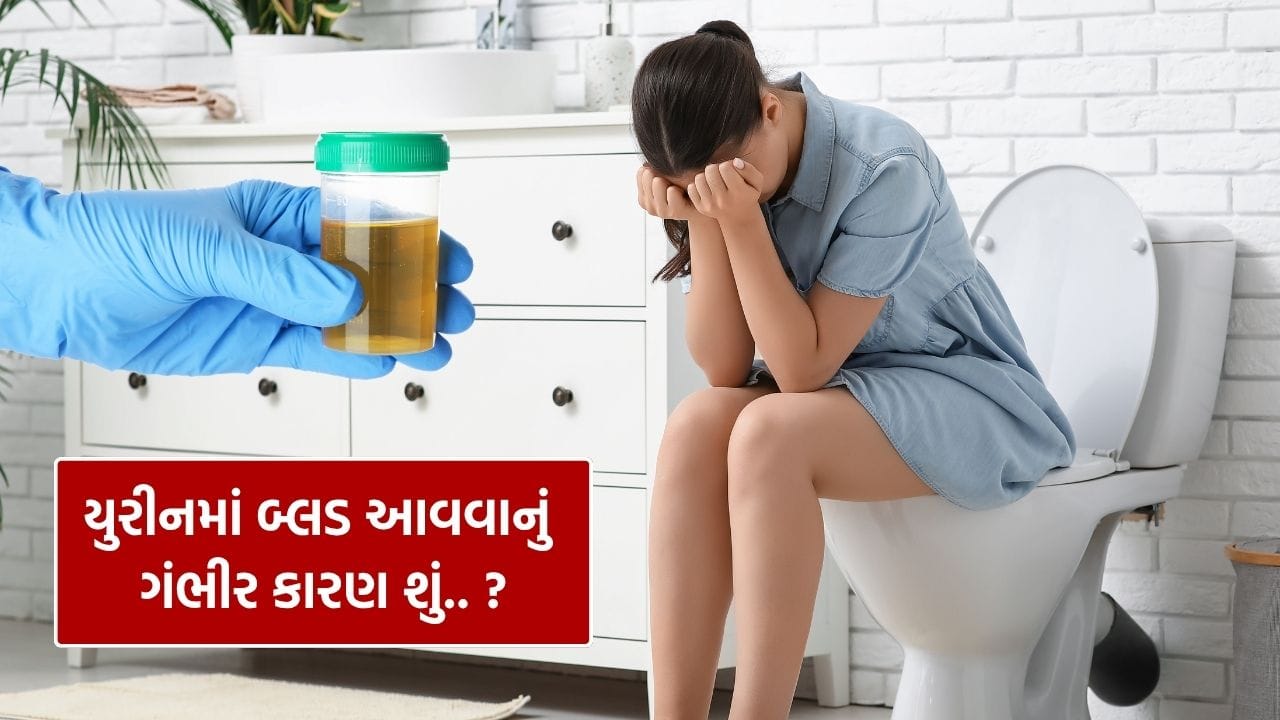 પેશાબમાં લોહી આવવું એક ગંભીર સંકેત હોઈ શકે છે અને તેને ક્યારેય અવગણવું જોઈએ નહીં. ઘણી વાર તે નાની સમસ્યાનો ઈશારો હોય છે, પરંતુ કેટલીકવાર તે ગંભીર બીમારીઓનું લક્ષણ પણ બની શકે છે. પેશાબમાં લોહી આવવાના કારણોમાં ચેપ, ઈજા અથવા અંદર રહેલી કોઈ મોટી તકલીફ સામેલ હોઈ શકે છે. તેથી, યોગ્ય સમય પર નિદાન અને સારવાર ખૂબ જ જરૂરી છે.