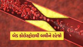 હાઈ બેડ કોલેસ્ટ્રોલ છે ? આજે જ આ વસ્તુ ખાવાનું બંધ કરો