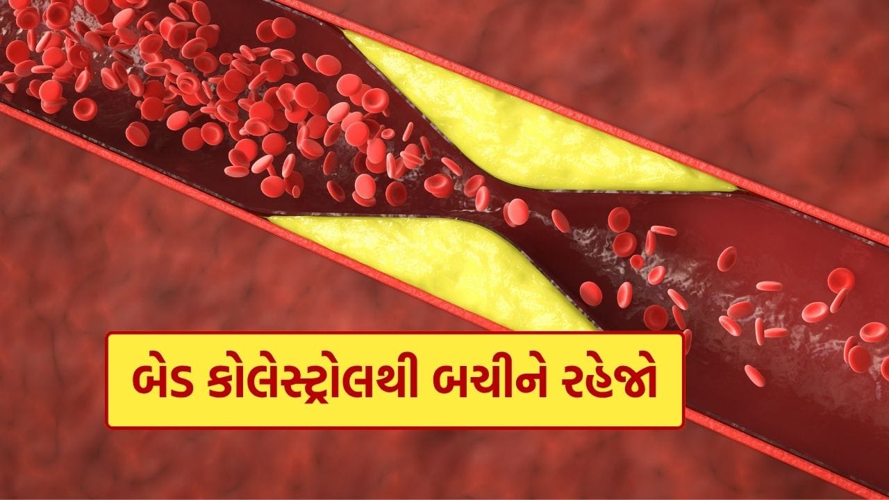 આજના સમયમાં નાની ઉંમરના લોકો પણ ખરાબ કોલેસ્ટ્રોલનો ભોગ બની રહ્યા છે. આ એક ‘સાયલેન્ટ’ સમસ્યા છે, જે સમયસર ધ્યાન ન આપીએ તો ગંભીર બની શકે છે. કોલેસ્ટ્રોલ ધીમે ધીમે નસોમાં જમા થવા લાગે છે, જેના કારણે બ્લડ ફ્લો પર અસર પડે છે અને બ્લડ પ્રેશર વધે છે. અંતે, આ હાર્ટ એટેક જેવી સ્થિતિ ઉભી કરી શકે છે.