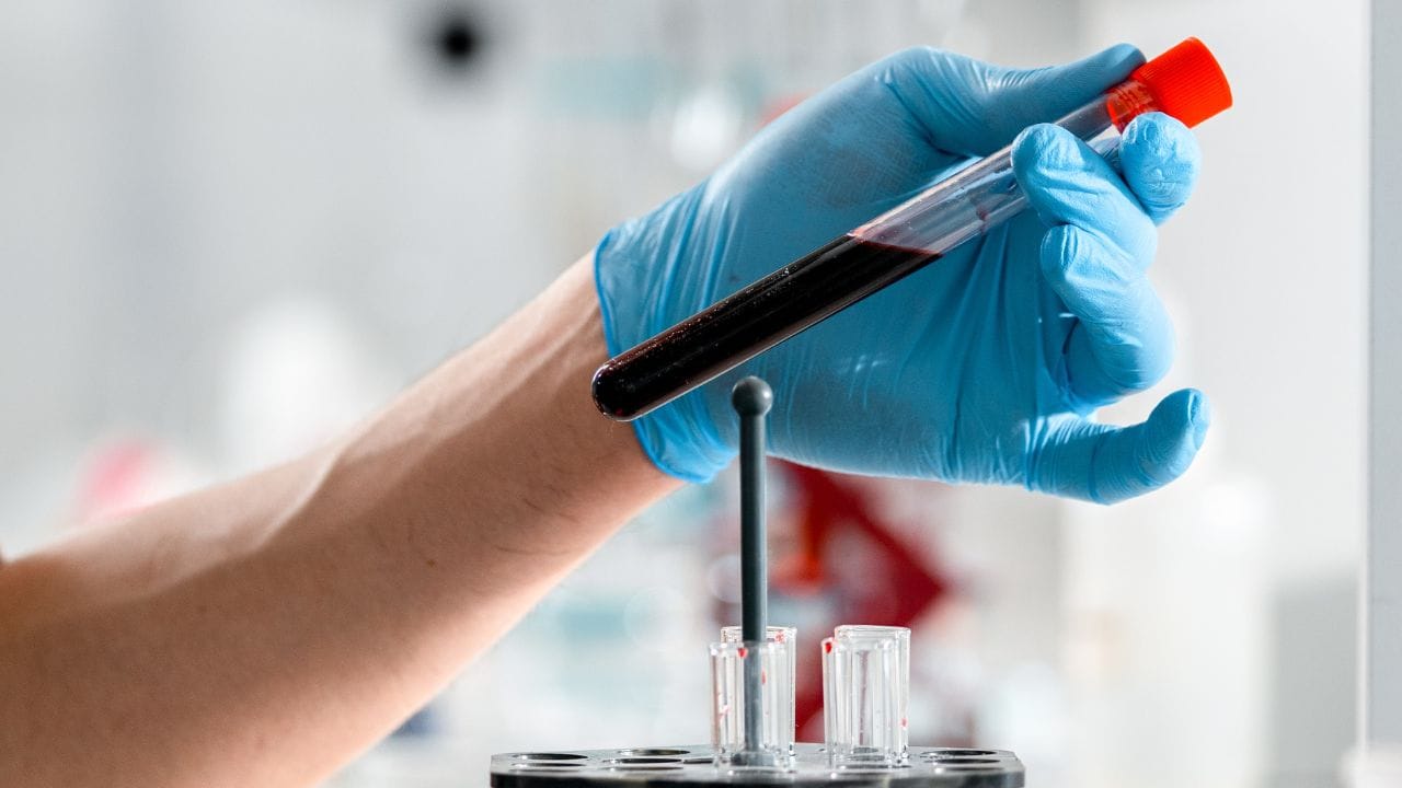 સુપ્રીમ કોર્ટ મહત્વનો નિર્ણય સંભળાવતા કહ્યું કે, જો એ સ્પષ્ટ થાય  કે, કોઈ વ્યક્તિ બાળકનો જૈવિક પિતા નથી. તો તેને બાળકના ભરણપોષણ આપવા માટે કહી શકાય નહી. ભલે બાળક લગ્ન દરમિયાન કેમ જન્મયું ન હોય. આ નિર્ણય જસ્ટિસ સંજય કરોલ અને જસ્ટિસ એન કોટિશ્વર સિંહને બેંચે સંભળાવ્યો છે.