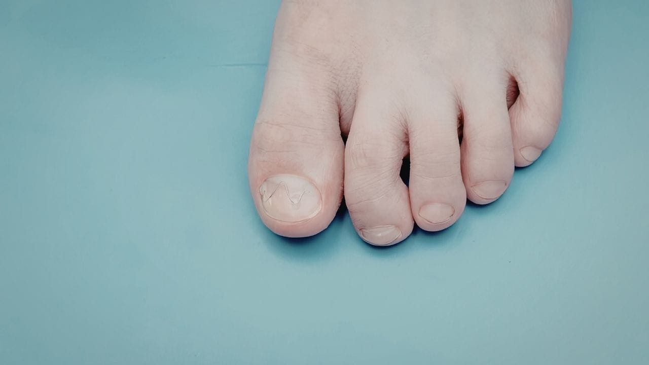 જો પહેલી આંગળી અંગૂઠા કરતાં ટૂંકી હોય, તો તે શાંત અને સંવેદનશીલ સ્વભાવ દર્શાવે છે. આવી વ્યક્તિઓ સંબંધોમાં સંતુલન જાળવવાનો પ્રયાસ કરે છે અને બીજાની લાગણીઓને સમજવામાં નિષ્ણાત હોય છે.