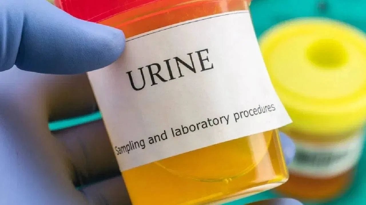 વારંવાર પેશાબ કરવો, ખાસ કરીને રાત્રે, ગંભીર બીમારીનો સંકેત હોઈ શકે છે, અને તમારે ડૉક્ટરનો સંપર્ક કરવો જોઈએ.
