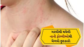 ગરમીના રેશિઝથી છુટકારો મેળવવા માટે આ સરળ નુસખા અજમાવો