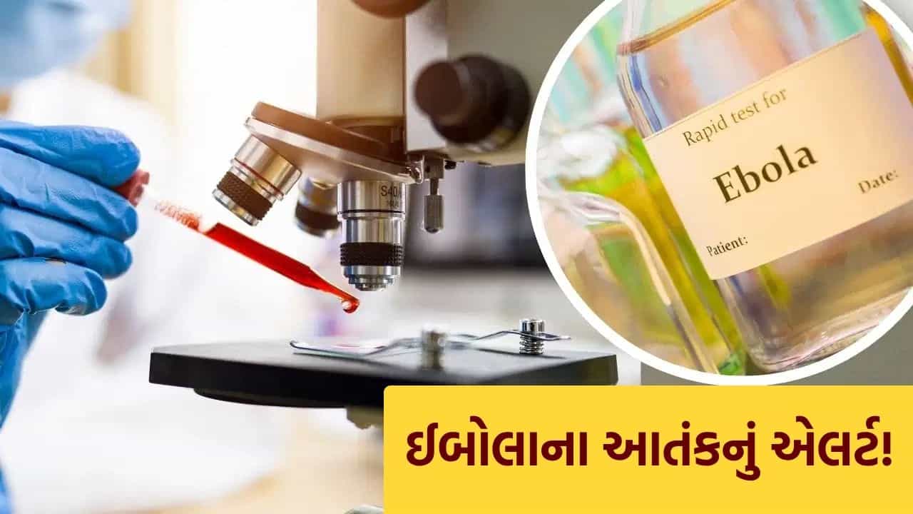 Breaking News : WHO એ ઇબોલાને હેલ્થ ઇમરજન્સી જાહેર કરી, IMA એ દેશભરના ડોકટરોને આપી ચેતવણી