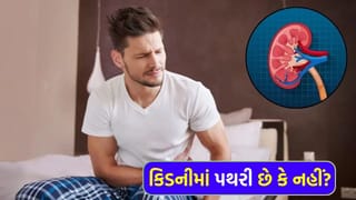 કિડનીમાં પથરી છે કે નહીં ? આ 5 સંકેતથી તરત ખબર પડી જશે, ભૂલથી પણ બેદરકારી ન રાખતા
