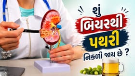 શું બિયર પીવાથી કિડની સ્ટોન નીકળી જાય છે, શું કહે છે યુરોલોજિસ્ટે ?