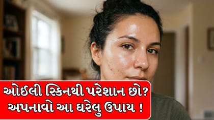 ઓઈલી સ્કિનથી પરેશાન છો? ચોમાસામાં ચહેરા પર લગાવો આ વસ્તુઓ, મળશે રાહત !