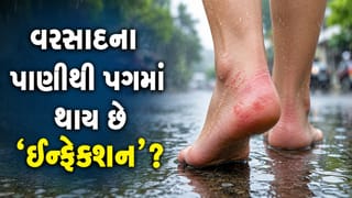 ચોમાસામાં પગમાં ખંજવાળ અને ઈન્ફેક્શનથી પરેશાન છો ? અપનાવો આ સરળ ઘરગથ્થુ ઉપાયો