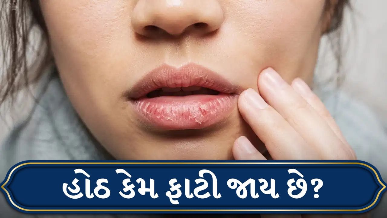 Lip Care: શું તમારા હોઠ વારંવાર ફાટી જાય છે ? આ પોષક તત્વોનો અભાવ તેનું કારણ હોઈ શકે છે