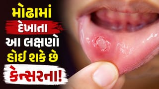 મોઢાની નાની તકલીફ બની શકે છે જીવલેણ ? દાંત ઢીલા પડવા કે ગળામાં સતત સોજો રહેવો એ કેન્સરની નિશાની તો નથી ને !