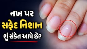 તમારા નખ પર પણ છે આવું સફેદ નિશાન? તો જાણો ખરેખર ભાગ્યશાળી છો કે નહીં