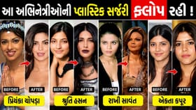 આ બોલિવુડ અભિનેત્રીઓની પ્લાસ્ટિક સર્જરી ફ્લોપ રહી