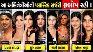 બોલિવુડમાં હિટ થવા બોલિવુડ અભિનેત્રીઓએ પ્લાસ્ટિક સર્જરી કરાવી, પરંતુ રહી ફ્લોપ, જુઓ ફોટો