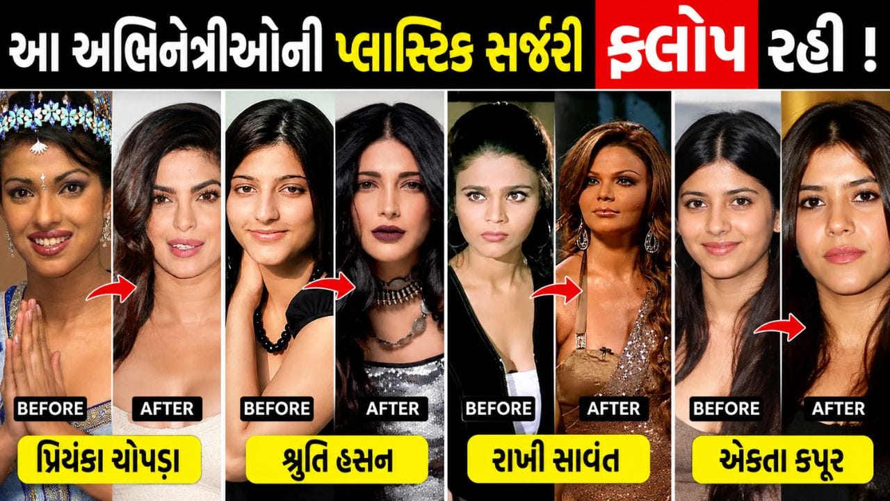 ગ્લેમર્સ વર્લ્ડ અને ઈન્ડસ્ટ્રીમાં હંમેશા પરફેક્ટ દેખાવવા માટે તેમજ સ્ક્રીન પર બેસ્ટ પોઝ આપવા સ્ટાર માટે એક પ્રોફેશનલ વાત છે.કેટલીક વખત સુંદર દેખાવવા માટે અભિનેત્રીઓ પ્લાસ્ટિક સર્જરી કરાવે છે. આજે 15 જુલાઈના રોજ વર્લ્ડ પ્લાસ્ટિક સર્જરી ડે છે. તો ચાલો જાણીએ કઈ કઈ અભિનેત્રીએ પ્લાસ્ટિક સર્જરી કરાવી છે.