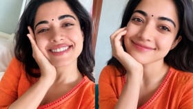 ગંભીર ઈજા બાદ રશ્મિકા મંદાનાએ શેર કરી હેલ્થ અપડેટ !
