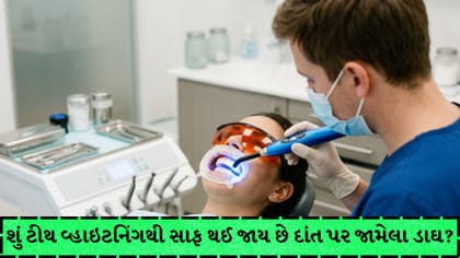 ટીથ વ્હાઇટનિંગ કરાવતા પહેલાં જાણો ફાયદા અને નુકસાન, કોણે ન કરાવવું?